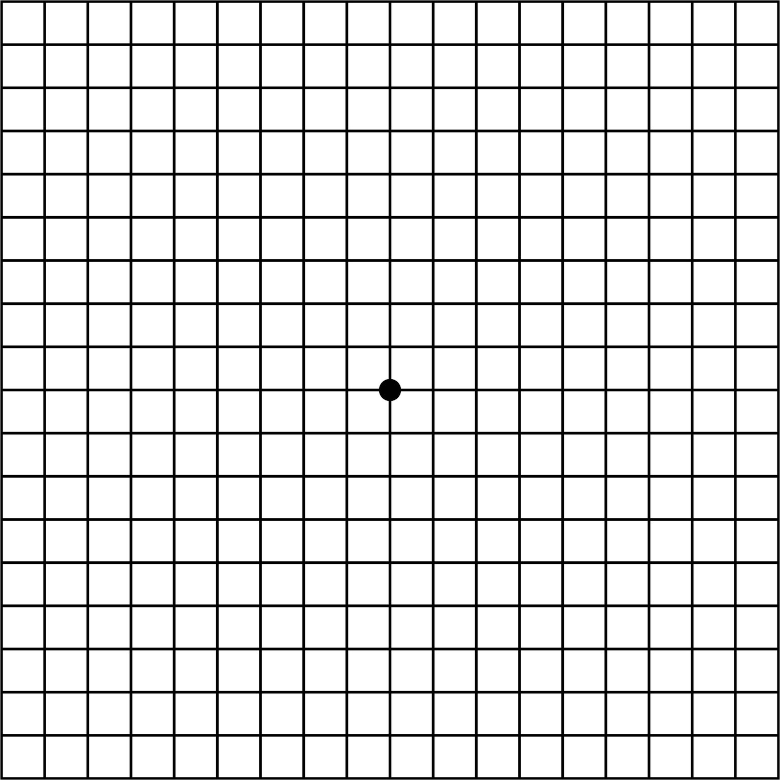 Amsler Grid